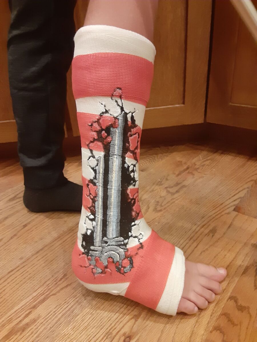 My BIL is a pretty amazing amateur artist. His son broke his foot and  needed a cast. They did a candy cane cast without